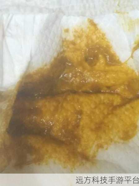 宝宝夹的好紧都拉丝了正常吗图片:宝宝夹得太紧拉丝,正常现象还是需要注意?