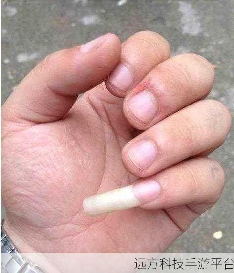 男生和女生拆拆很痛的轮滑鞋下载处：1. 男生女生共分享的轮滑鞋拆解痛点